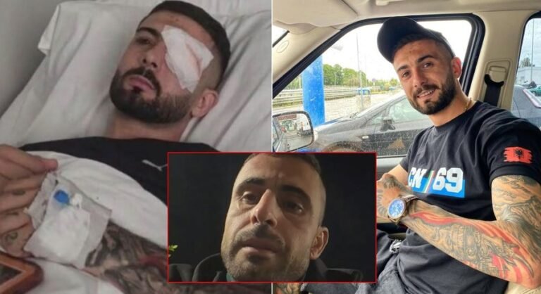 Dhuna e policisë dhe plagosja e Erjon Vishkulli
