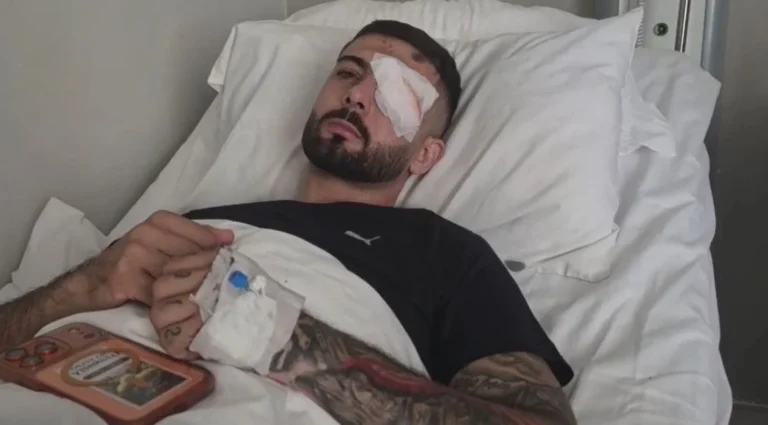 “Plumbin e kam ende në sy”/ Flet Erjon Vishkulli që u plagos në protestë: Isha 30 metra larg efektivëve, po rrija